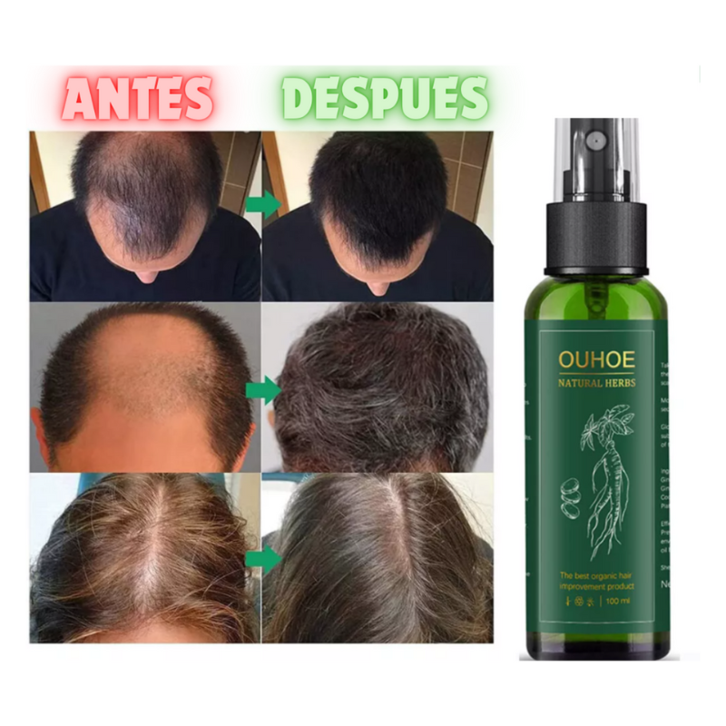 🌿 OUHOE - Spray para el crecimiento capilar ✨ + ENVIO GRATIS 🚚