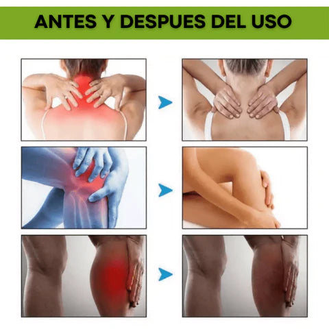 2x1 beevana  🐝 -  Crema De veneno de abeja DILE ADIOS A LOS DOLORES  + ENVIO GRATIS TODO GUATEMALA🎁