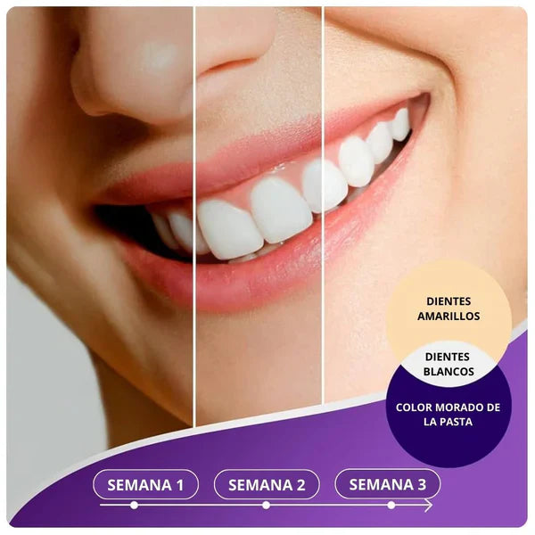 🪥🦷 Pasta Blanqueadora de Dientes Obssesive - ENVIO GRATIS 🚚